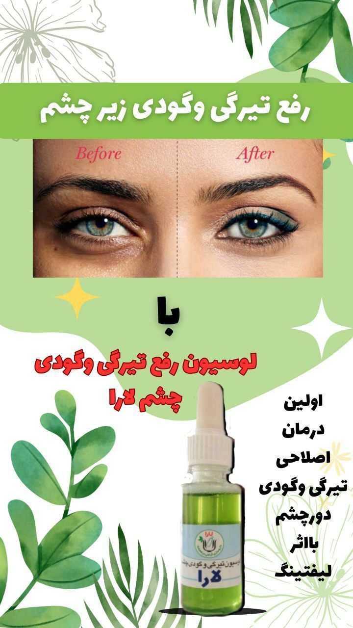 لوسیون رفع تیرگی و گودی زیر چشم تازه تولید نمونه اصل
